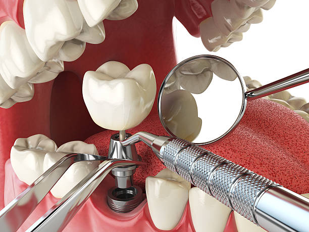 Best Weekend Emergency Dentist in Livingston, LA
